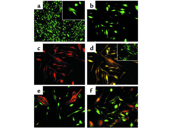 Immunohistochemistry using GFP FITC